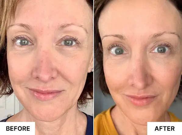 Before and After Result